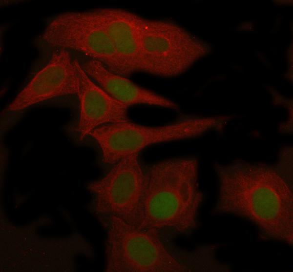 3 - Anti-HMGB1/Hmg 1 Rabbit Monoclonal Antibody ABO13578