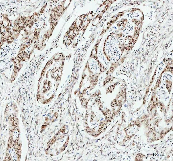 2 - Anti-HMGB1/Hmg 1 Rabbit Monoclonal Antibody ABO13578