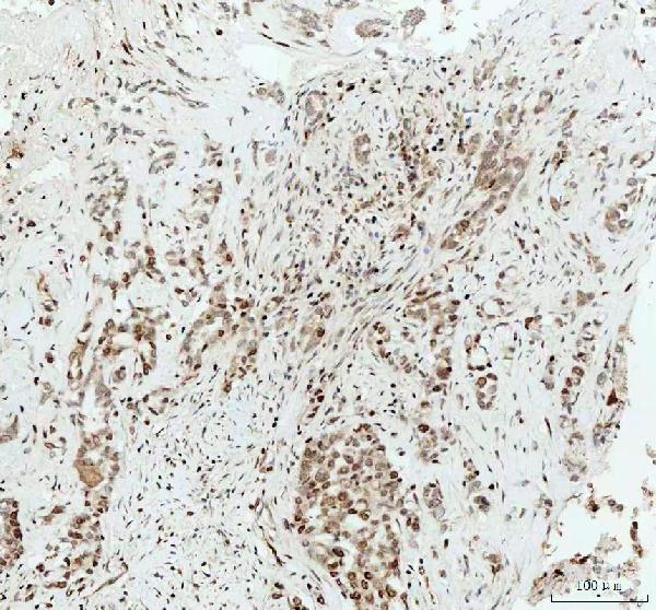 2 - Anti-HMGB1/Hmg 1 Rabbit Monoclonal Antibody ABO13578