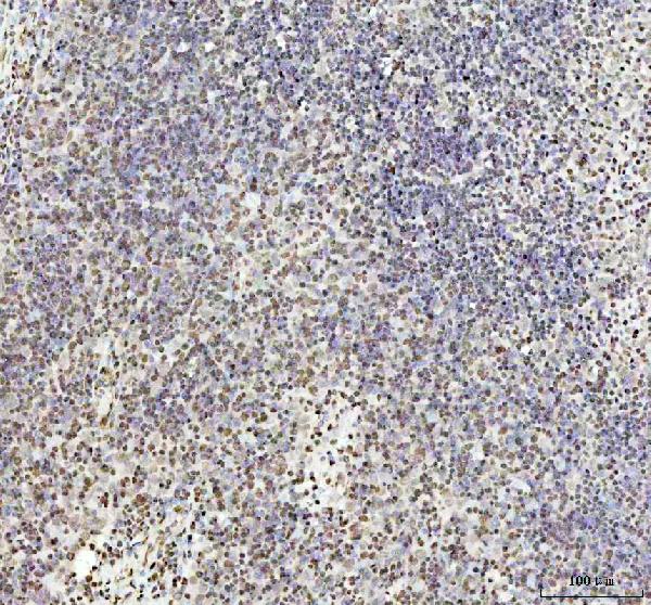 2 - Anti-HMGB1/Hmg 1 Rabbit Monoclonal Antibody ABO13578