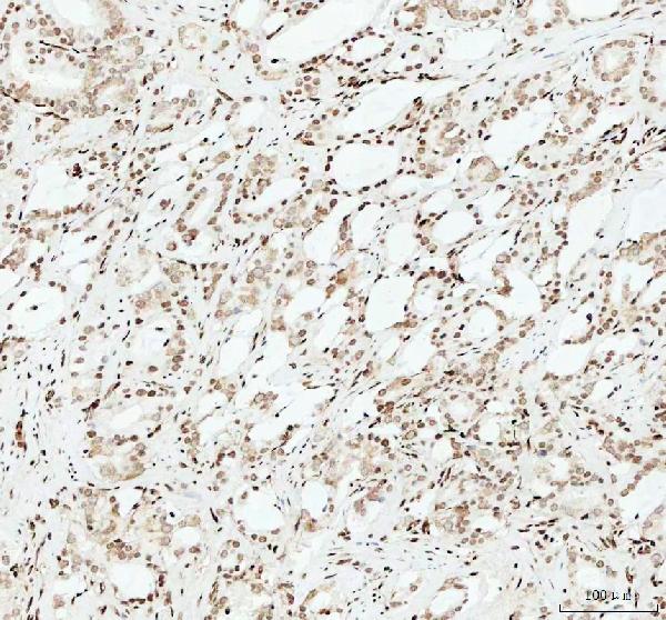 2 - Anti-HMGB1/Hmg 1 Rabbit Monoclonal Antibody ABO13578