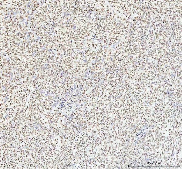 2 - Anti-HMGB1/Hmg 1 Rabbit Monoclonal Antibody ABO13578