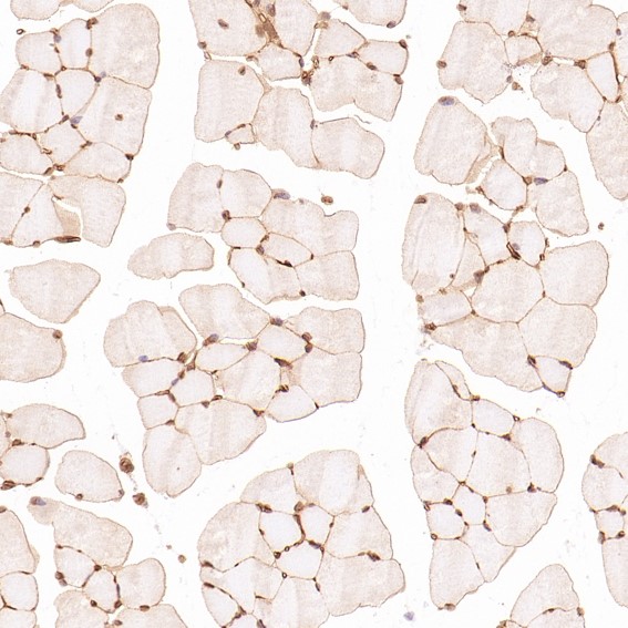 2 - Anti-HMGB1/Hmg 1 Rabbit Monoclonal Antibody ABO13578