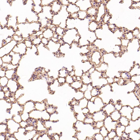 2 - Anti-HMGB1/Hmg 1 Rabbit Monoclonal Antibody ABO13578