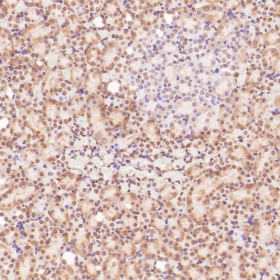 2 - Anti-HMGB1/Hmg 1 Rabbit Monoclonal Antibody ABO13578