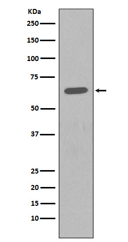 1 - Anti-HDAC2/Histone Deacetylase 2 Rabbit Monoclonal Antibody ABO13579