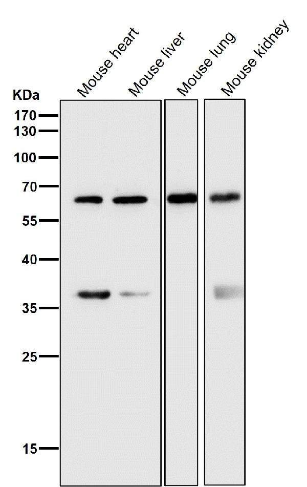 1 - Anti-HDAC2/Histone Deacetylase 2 Rabbit Monoclonal Antibody ABO13579