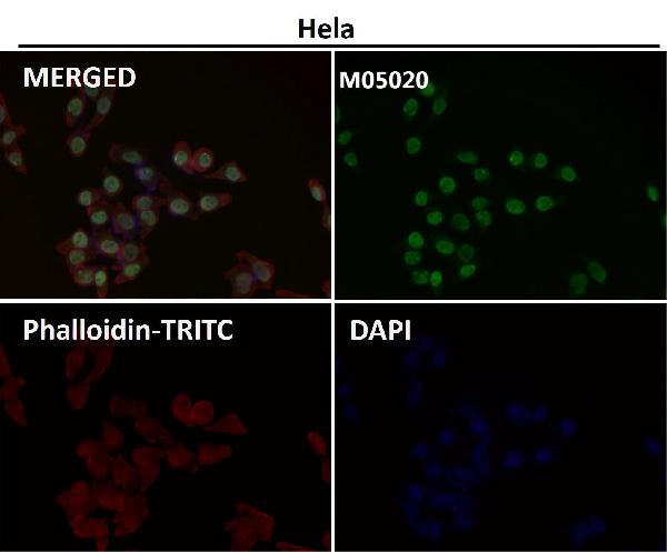 1 - Anti-PTBP2 Rabbit Monoclonal Antibody ABO13582