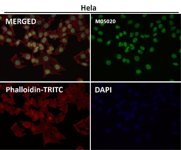 1 - Anti-PTBP2 Rabbit Monoclonal Antibody ABO13582