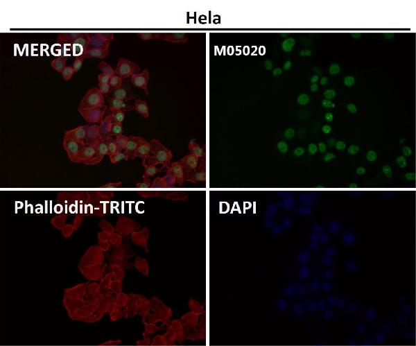 1 - Anti-PTBP2 Rabbit Monoclonal Antibody ABO13582