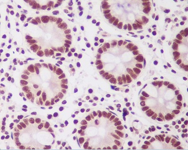 2 - Anti-PTBP2 Rabbit Monoclonal Antibody ABO13582