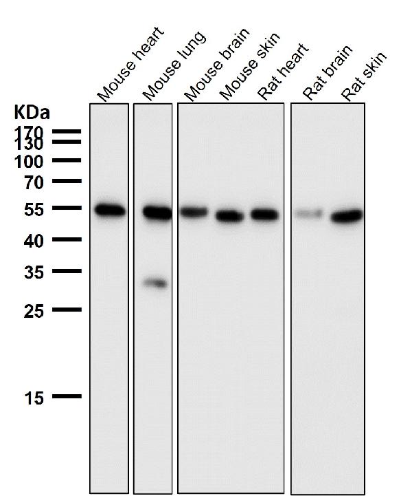 1 - Anti-PTBP2 Rabbit Monoclonal Antibody ABO13582