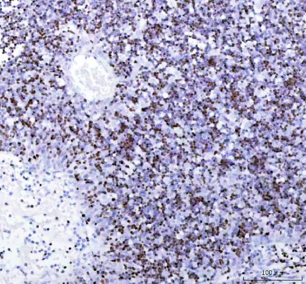 2 - Anti-SATB1 Rabbit Monoclonal Antibody ABO13583