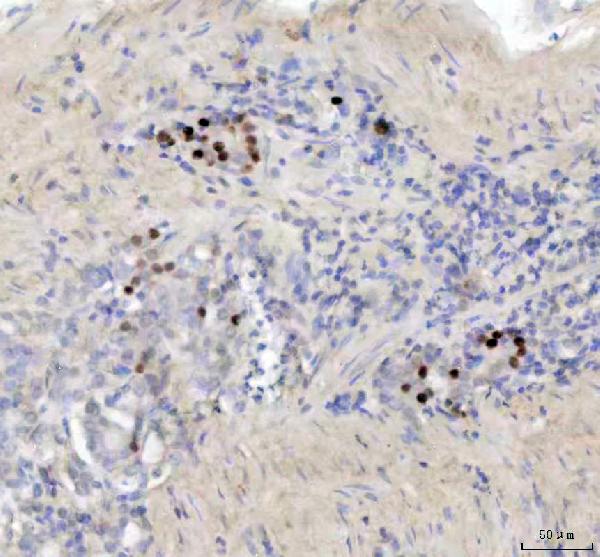 2 - Anti-SATB1 Rabbit Monoclonal Antibody ABO13583