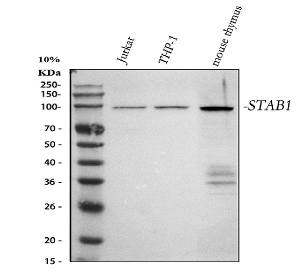 1 - Anti-SATB1 Rabbit Monoclonal Antibody ABO13583