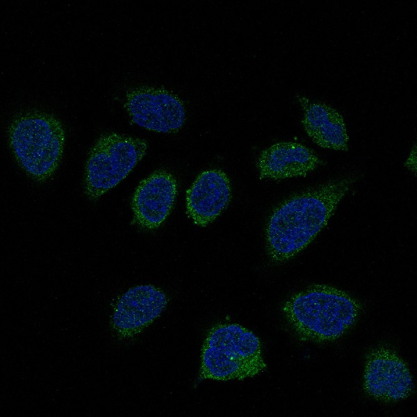 3 - Anti-Smad2 Rabbit Monoclonal Antibody ABO13585