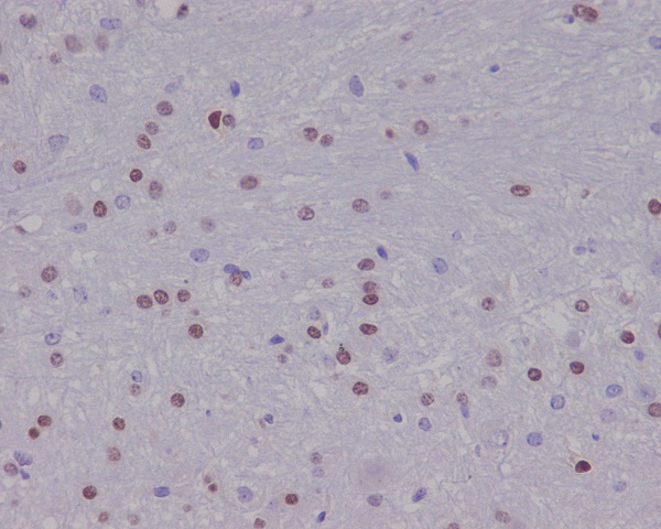 2 - Anti-Olig2 Rabbit Monoclonal Antibody ABO13586