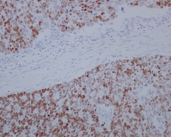 2 - Anti-SATB2 Rabbit Monoclonal Antibody ABO13587