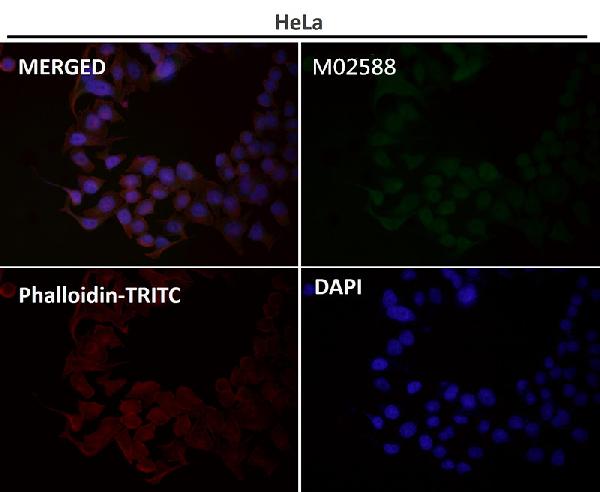 1 - Anti-SATB2 Rabbit Monoclonal Antibody ABO13587