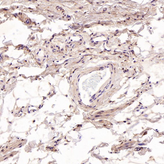 2 - Anti-SATB2 Rabbit Monoclonal Antibody ABO13587