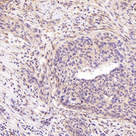 2 - Anti-SATB2 Rabbit Monoclonal Antibody ABO13587