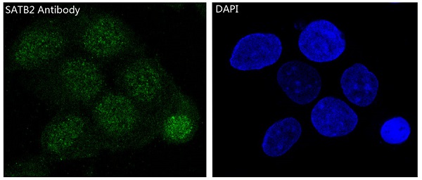 3 - Anti-SATB2 Rabbit Monoclonal Antibody ABO13587