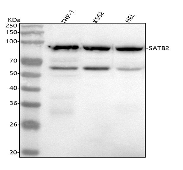 1 - Anti-SATB2 Rabbit Monoclonal Antibody ABO13587