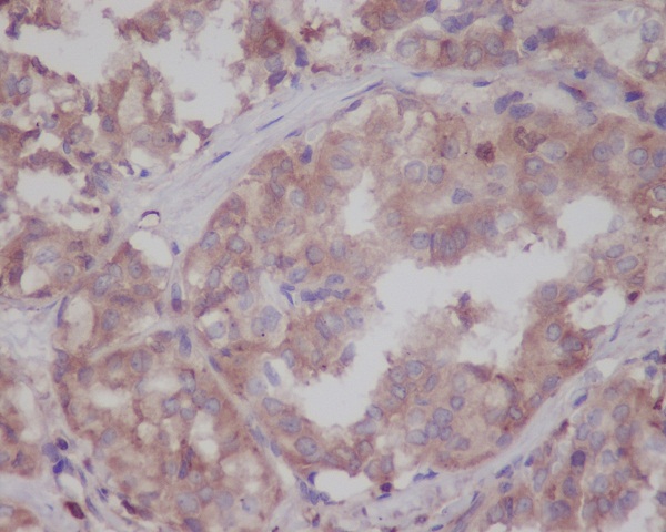 2 - Anti-LRRK2 Rabbit Monoclonal Antibody ABO13588