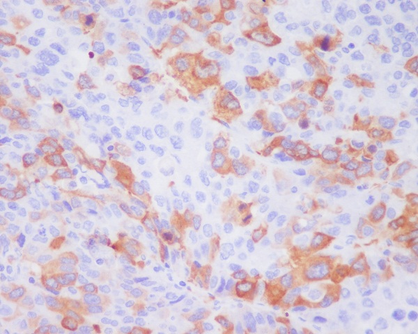 2 - Anti-TACC3 Rabbit Monoclonal Antibody ABO13589