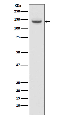 1 - Anti-TACC3 Rabbit Monoclonal Antibody ABO13589