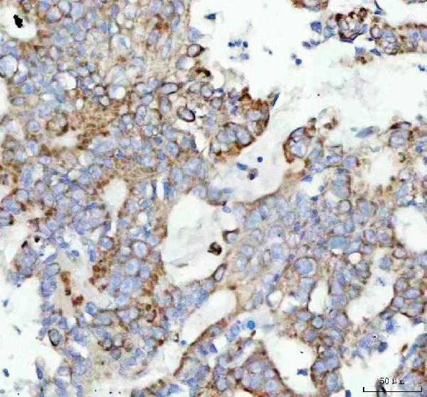 2 - Anti-GM130 GOLGA2 Rabbit Monoclonal Antibody ABO13590