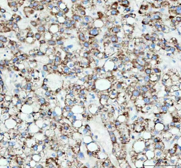 2 - Anti-GM130 GOLGA2 Rabbit Monoclonal Antibody ABO13590