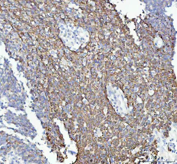 2 - Anti-GM130 GOLGA2 Rabbit Monoclonal Antibody ABO13590