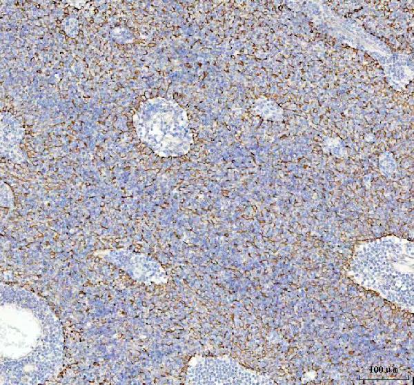 2 - Anti-GM130 GOLGA2 Rabbit Monoclonal Antibody ABO13590