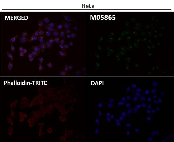 1 - Anti-GM130 GOLGA2 Rabbit Monoclonal Antibody ABO13590