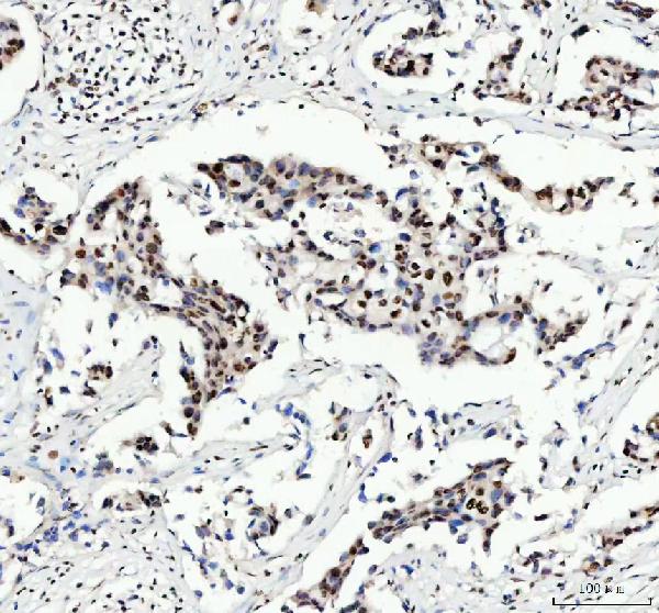 2 - Anti-FUBP1 Rabbit Monoclonal Antibody ABO13591