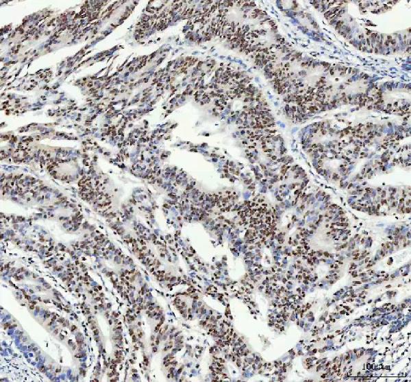 2 - Anti-FUBP1 Rabbit Monoclonal Antibody ABO13591