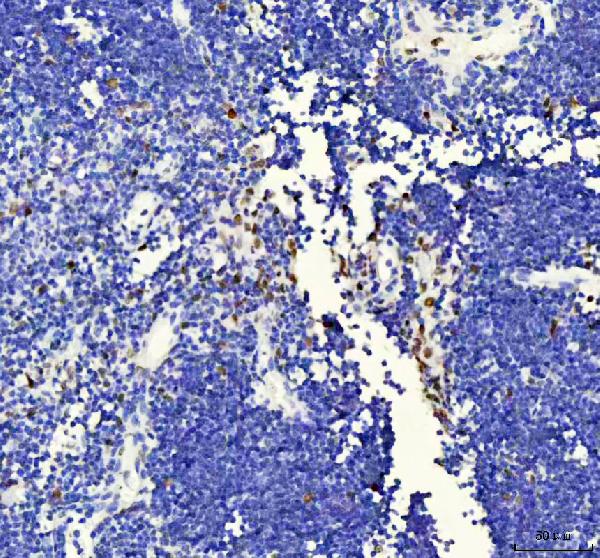 2 - Anti-FUBP1 Rabbit Monoclonal Antibody ABO13591