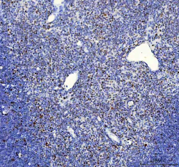 2 - Anti-FUBP1 Rabbit Monoclonal Antibody ABO13591