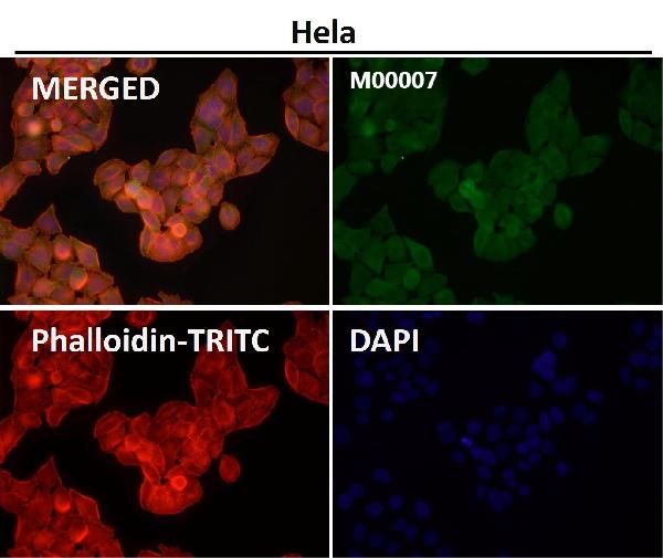 1 - Anti-STAT3 Rabbit Monoclonal Antibody ABO13594