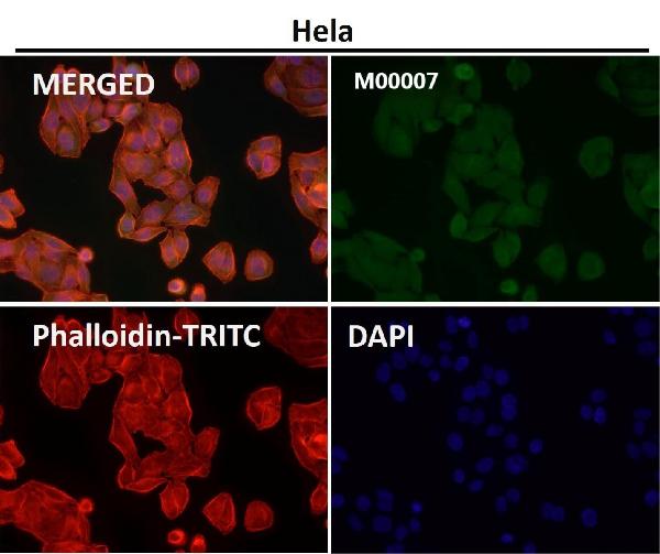 1 - Anti-STAT3 Rabbit Monoclonal Antibody ABO13594