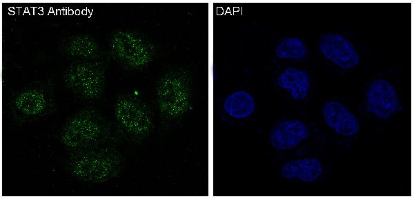 3 - Anti-STAT3 Rabbit Monoclonal Antibody ABO13594