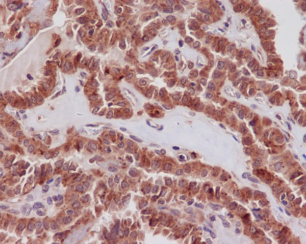 2 - Anti-STAT3 Rabbit Monoclonal Antibody ABO13594
