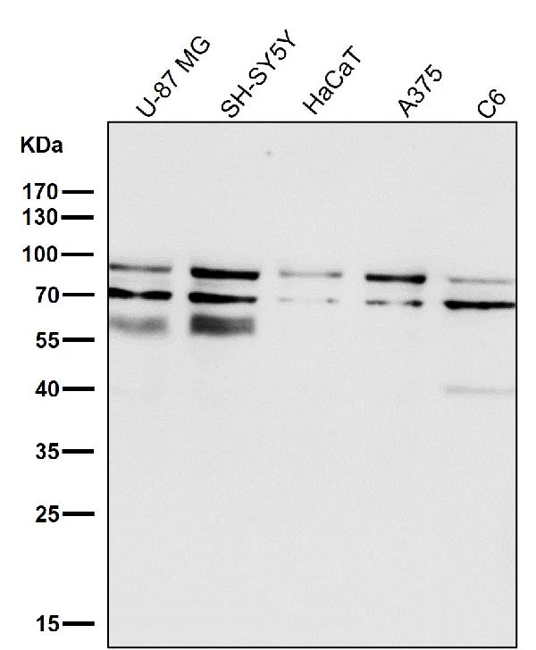 1 - Anti-STAT3 Rabbit Monoclonal Antibody ABO13594