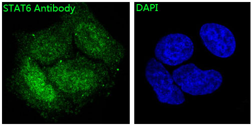 3 - Anti-STAT6 Rabbit Monoclonal Antibody ABO13595
