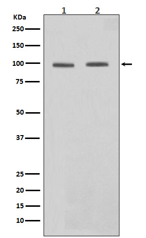 1 - Anti-STAT6 Rabbit Monoclonal Antibody ABO13595