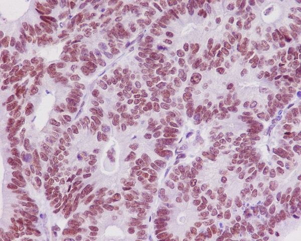 2 - Anti-TRAF6 Rabbit Monoclonal Antibody ABO13596