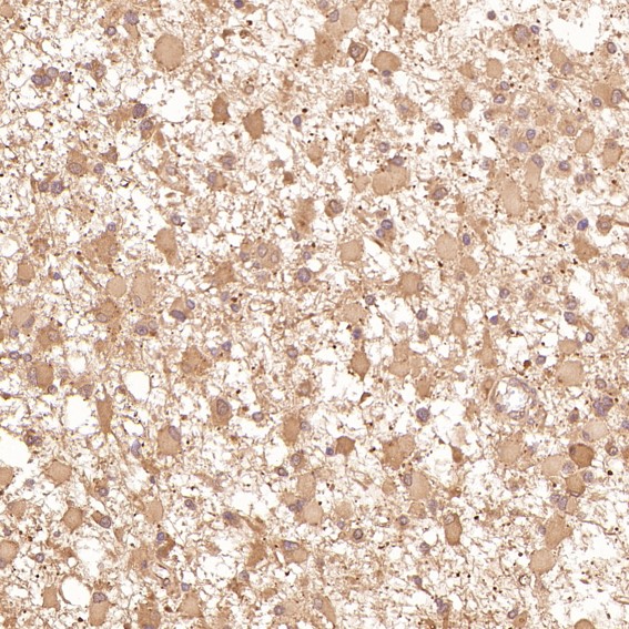 2 - Anti-TRAF6 Rabbit Monoclonal Antibody ABO13596