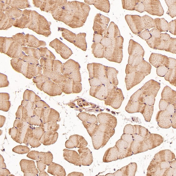 2 - Anti-TRAF6 Rabbit Monoclonal Antibody ABO13596