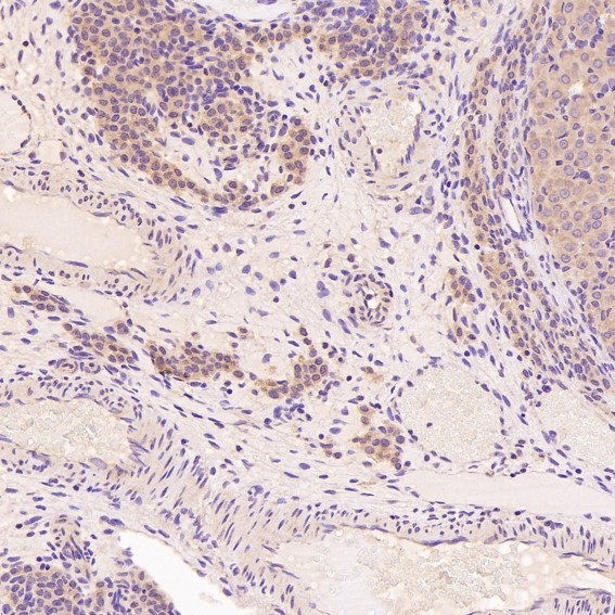 2 - Anti-TRAF6 Rabbit Monoclonal Antibody ABO13596